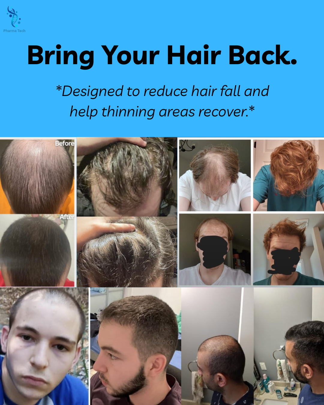 Novaxidil Triple Therapy Hair Regrowth Foam