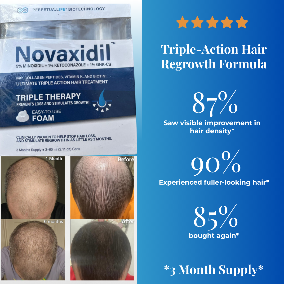 Novaxidil Triple Therapy Hair Regrowth Foam