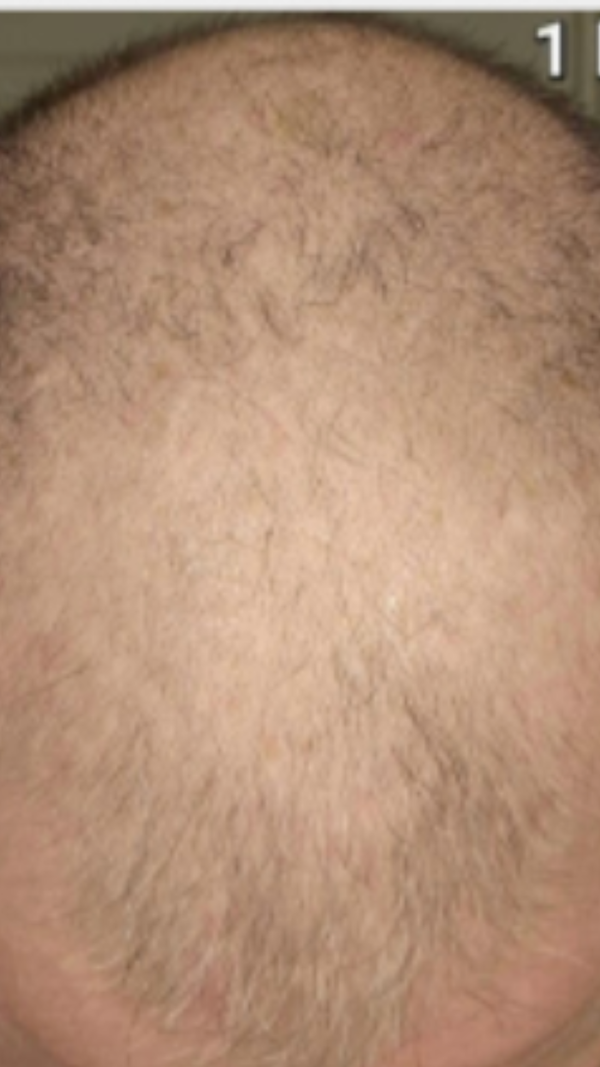 Before - Vincent