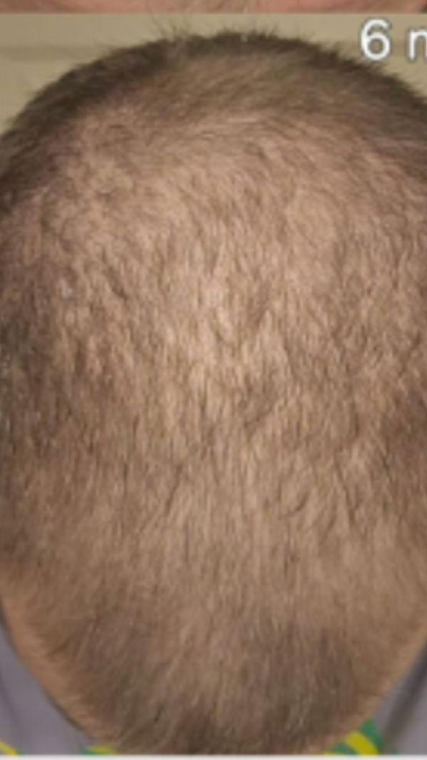 After - Vincent