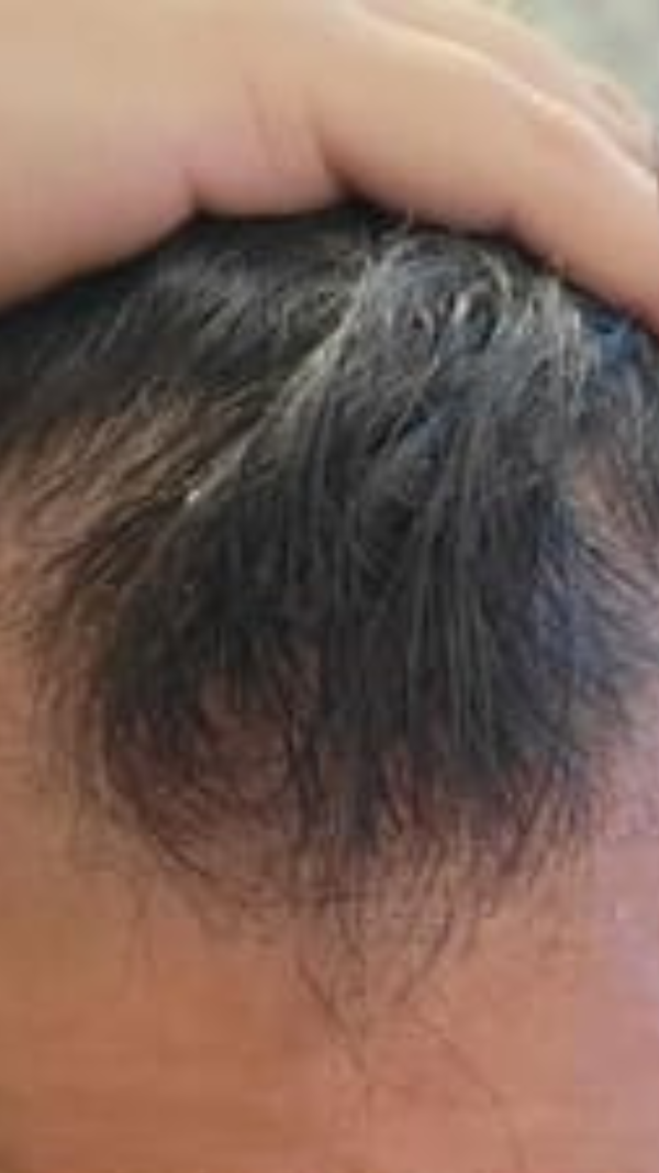 Before - Omar