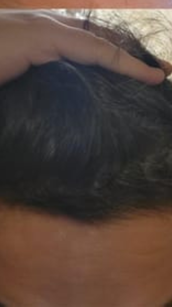 After - Omar