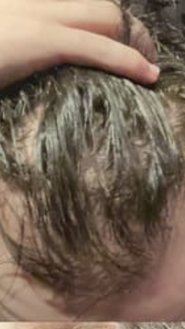 Before - Chris