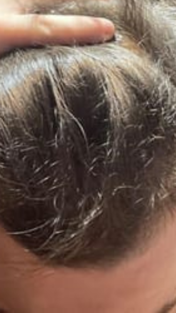 After - Chris