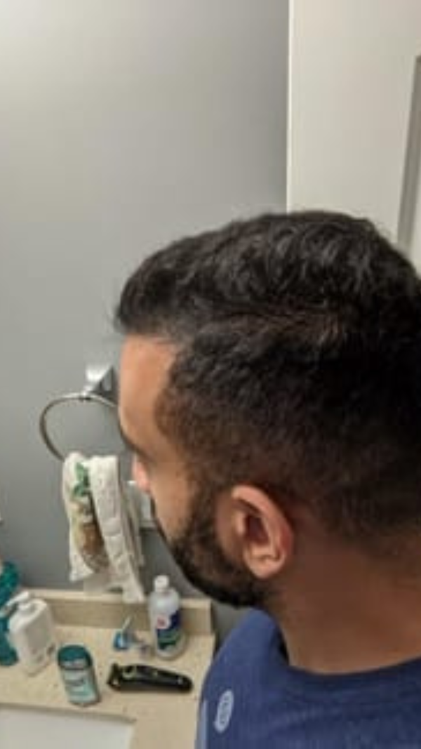 After - Ahmed