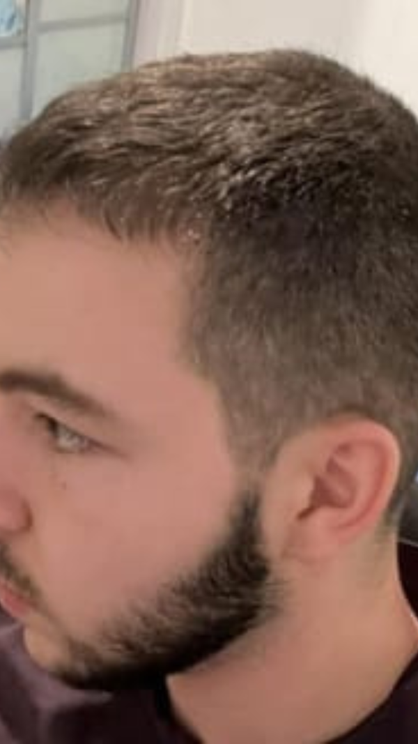After - Alex